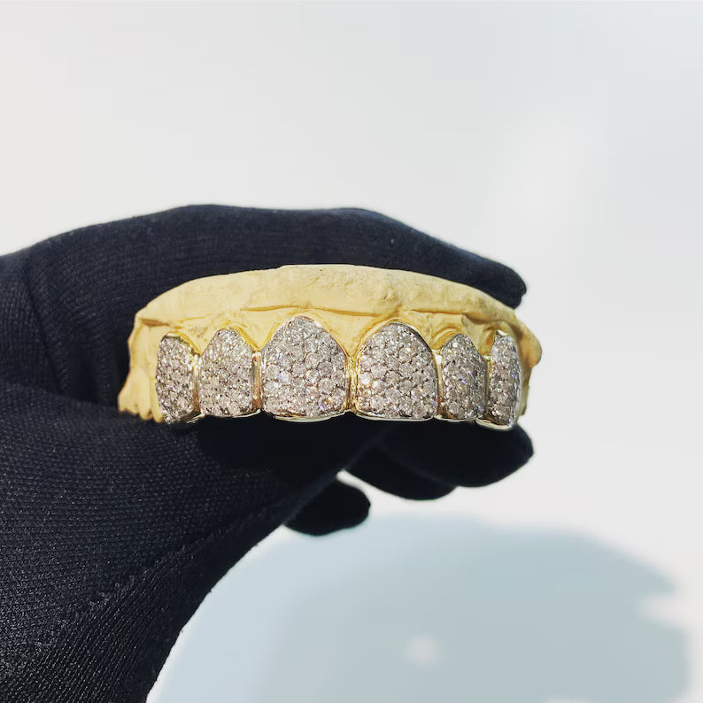 LAB DIAMOND VVS GRILLZ