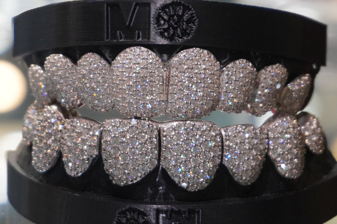 SALE SALE MOISSANITE  GRILLZ .