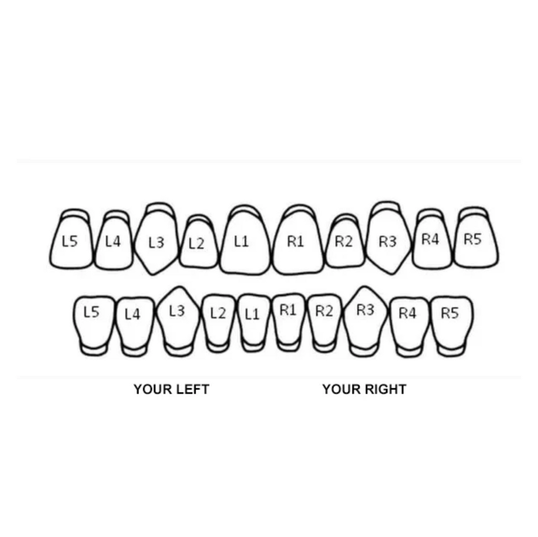 Solid Gold Grillz Diamond Cut & Diamond Dust 8 Set