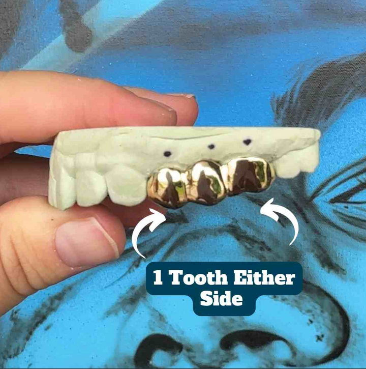 Solid Gold Grillz Diamond Cut & Diamond Dust 8 Set