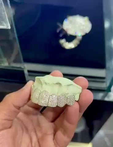 MOISSANITE GRILLZ
